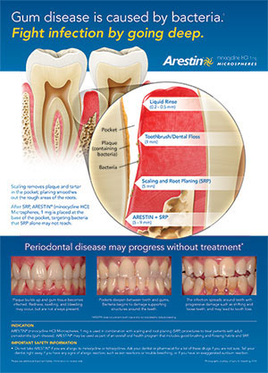 The image is an informational poster about oral health, specifically focusing on the prevention of gingivitis and the progression of periodontal disease. It features a detailed illustration of a mouth with various dental structures labeled, highlighting the importance of dental hygiene in preventing gum diseases such as gingivitis and periodontitis. The text on the poster emphasizes the need to fight infection by going deep, using Arestin as an example of a product that can help prevent these conditions.