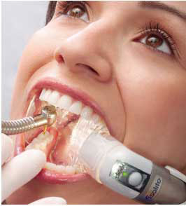The image depicts a person with their mouth open, receiving dental treatment or care, with a dental device inserted into the mouth and a visible dental implant.