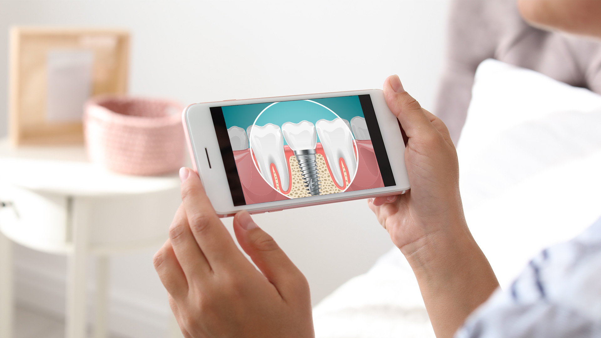 Person holding phone showing dental implant illustration.