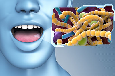 The image is a digital graphic featuring a 3D rendering of a human head with an open mouth, displaying a microscopic view of bacteria and viruses within the mouth.