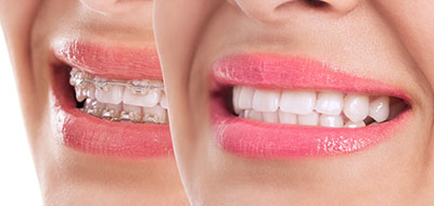 An image of a woman's smiling face with pink lipstick, showcasing her teeth and lips.