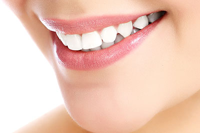 The image shows a close-up of a person's smile, with the focus on their teeth and lips.