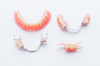 The image displays a collection of dental appliances, including braces and retainers, laid out on a white surface.