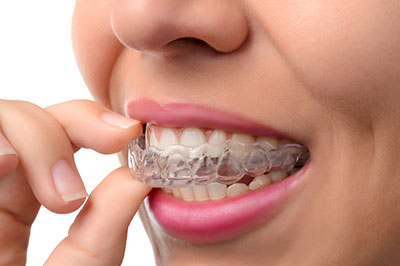 The image shows a person with clear braces, holding their finger to their mouth.