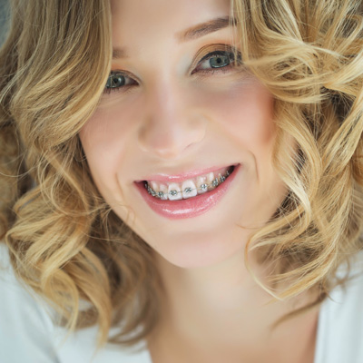A smiling woman with straight teeth and blond hair, wearing a white top.