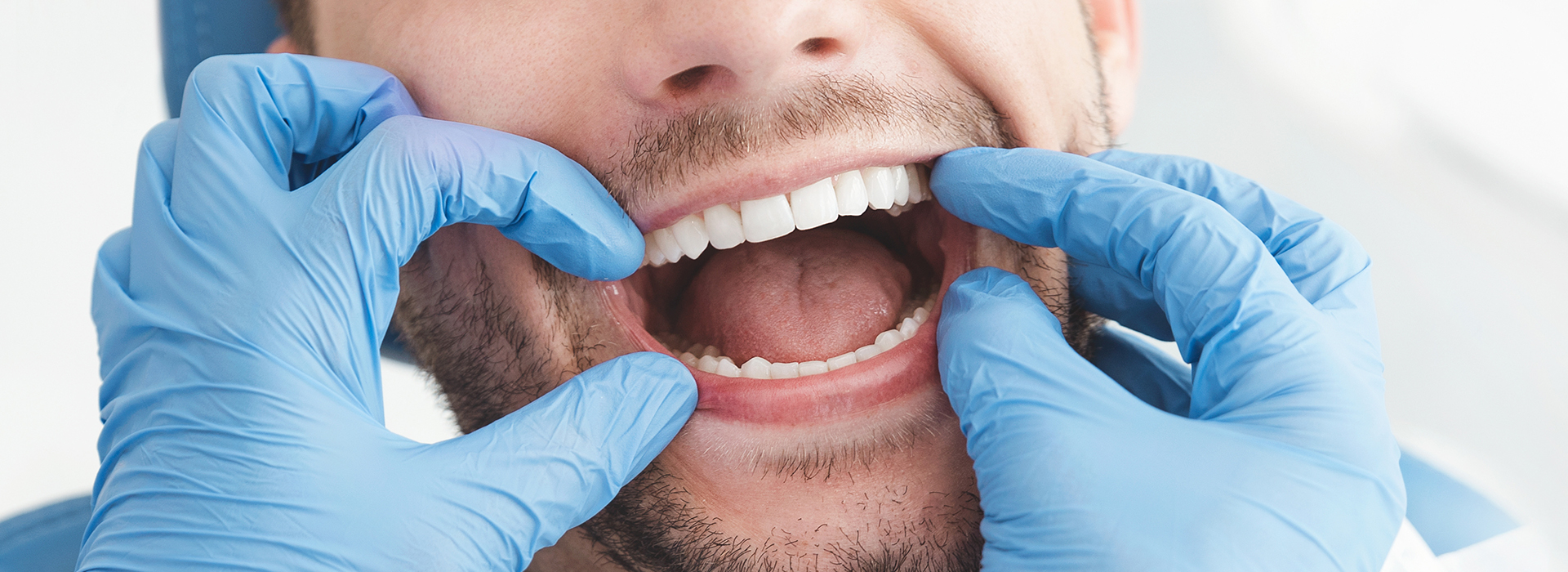 A dental professional wearing a surgical mask and gloves, with a patient's mouth opened wide for examination.