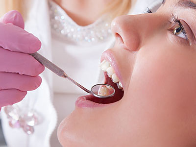 A dental professional performing a teeth cleaning procedure on a patient's mouth.